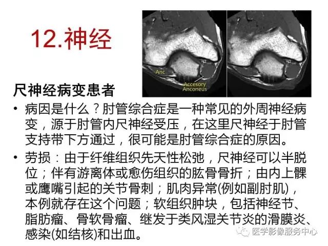 【PPT】肘关节MRI