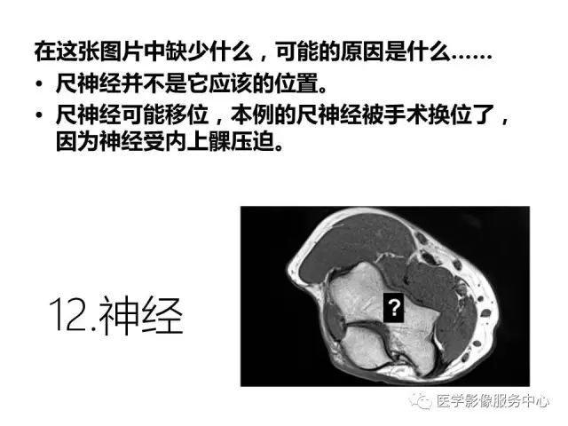 【PPT】肘关节MRI