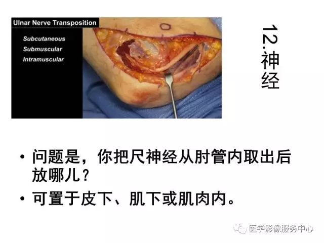 【PPT】肘关节MRI
