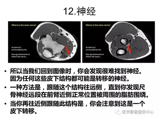 【PPT】肘关节MRI
