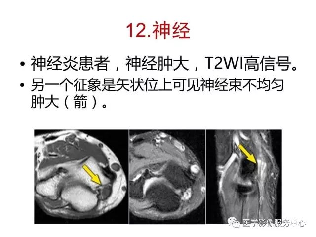 【PPT】肘关节MRI