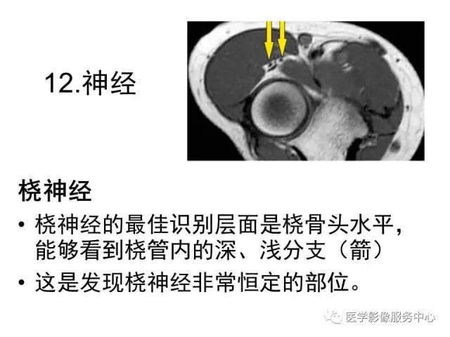 【PPT】肘关节MRI