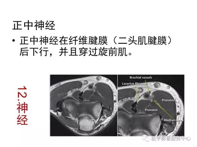 【PPT】肘关节MRI
