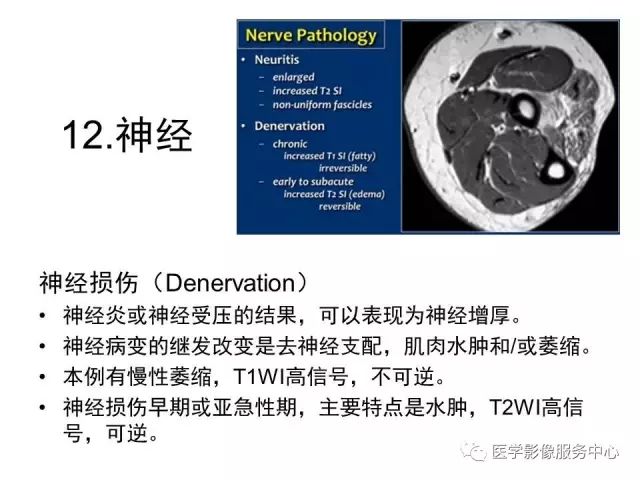 【PPT】肘关节MRI