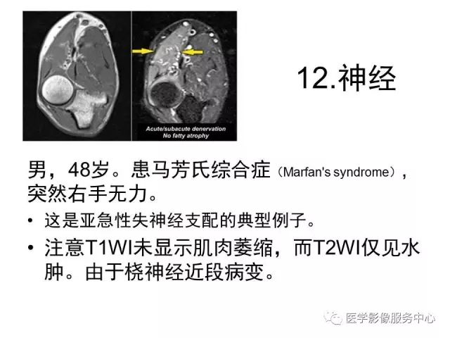 【PPT】肘关节MRI