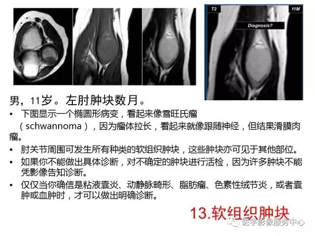 【PPT】肘关节MRI