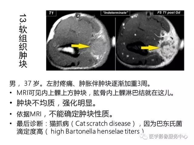 【PPT】肘关节MRI