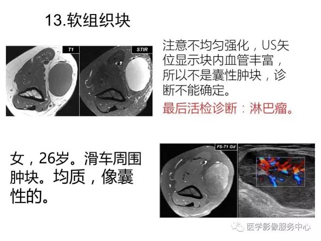 【PPT】肘关节MRI
