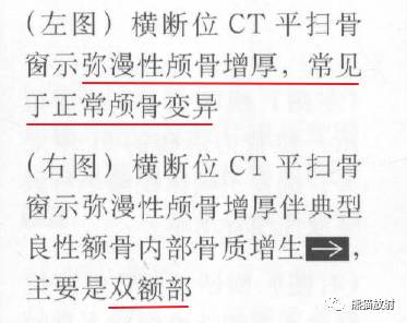【书摘】弥漫性/局限性颅骨增厚的鉴别诊断