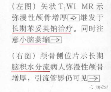 【书摘】弥漫性/局限性颅骨增厚的鉴别诊断