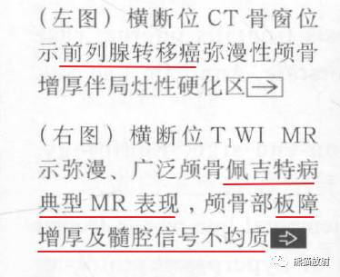 【书摘】弥漫性/局限性颅骨增厚的鉴别诊断