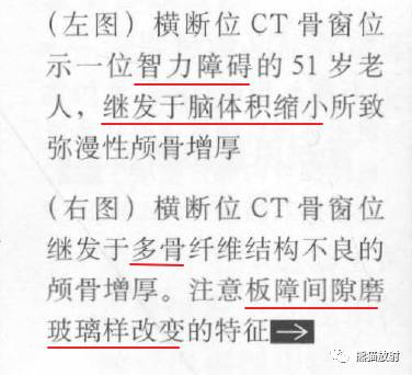【书摘】弥漫性/局限性颅骨增厚的鉴别诊断
