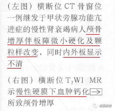 【书摘】弥漫性/局限性颅骨增厚的鉴别诊断