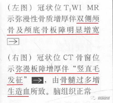 【书摘】弥漫性/局限性颅骨增厚的鉴别诊断