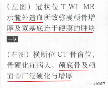 【书摘】弥漫性/局限性颅骨增厚的鉴别诊断