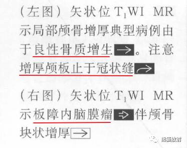 【书摘】弥漫性/局限性颅骨增厚的鉴别诊断