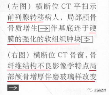 【书摘】弥漫性/局限性颅骨增厚的鉴别诊断