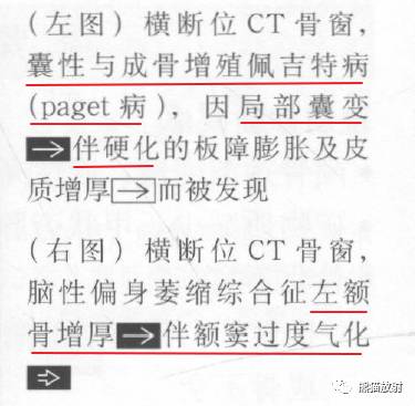 【书摘】弥漫性/局限性颅骨增厚的鉴别诊断