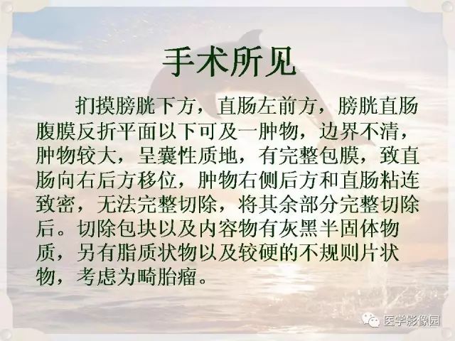 【病例】会阴部皮样囊肿1例CT影像表现