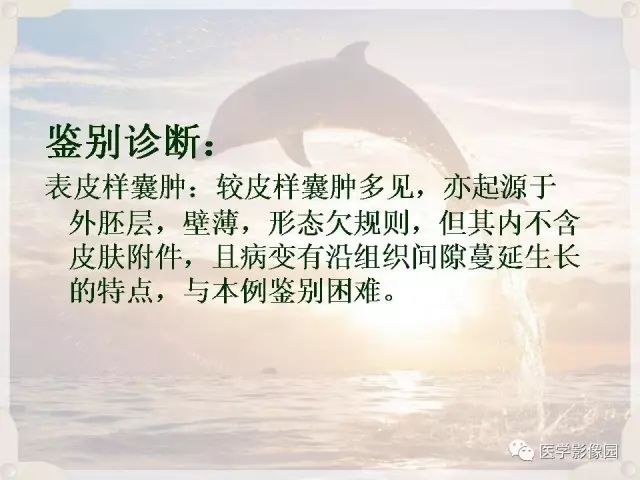 【病例】会阴部皮样囊肿1例CT影像表现