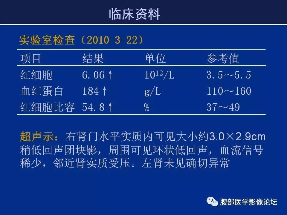 【病例】右侧后肾腺瘤1例CT及MR影像表现 【病例】右侧后肾腺瘤1例CT及MR影像表现