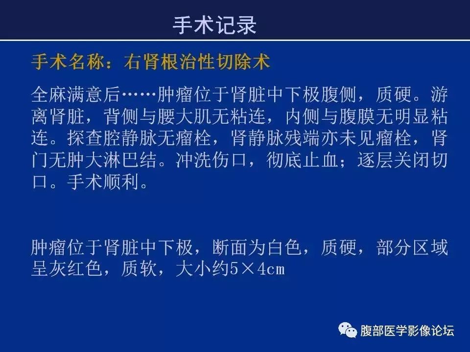 【病例】右侧后肾腺瘤1例CT及MR影像表现 【病例】右侧后肾腺瘤1例CT及MR影像表现