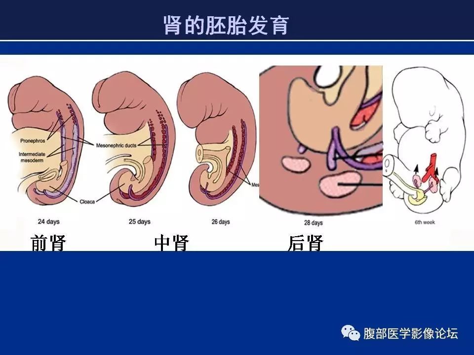 【病例】右侧后肾腺瘤1例CT及MR影像表现 【病例】右侧后肾腺瘤1例CT及MR影像表现