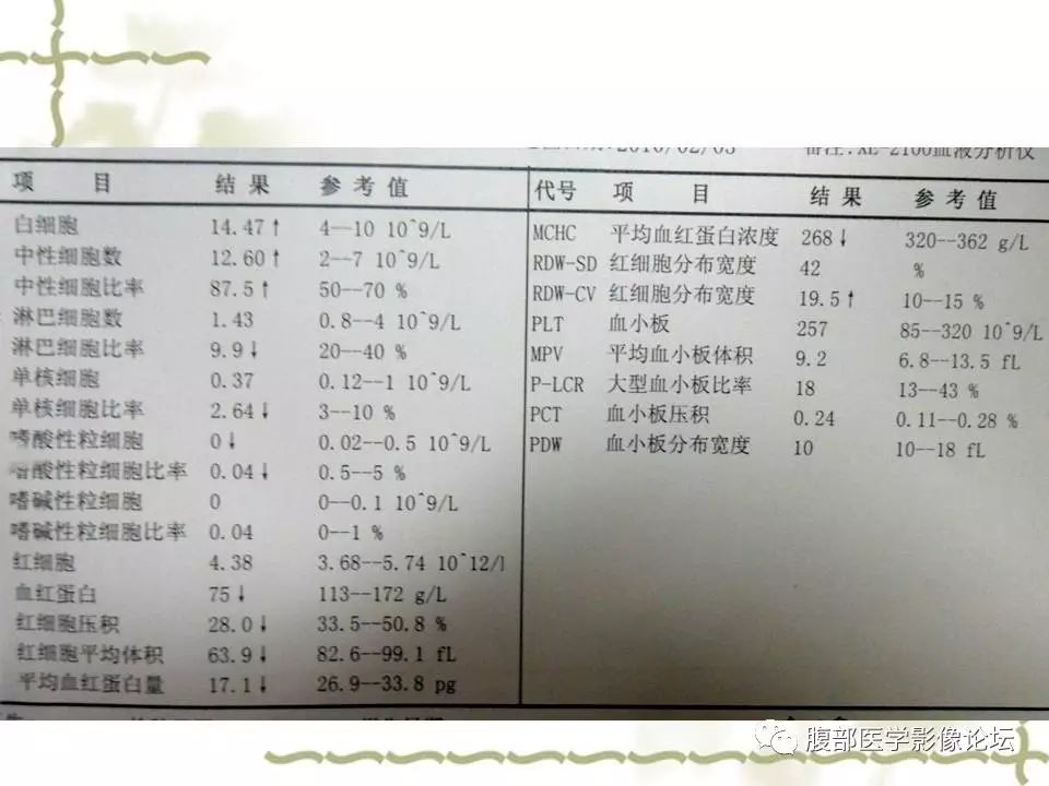 【病例】胰头浆液性囊腺瘤1例CT及MR 【病例】胰头浆液性囊腺瘤1例CT及MR