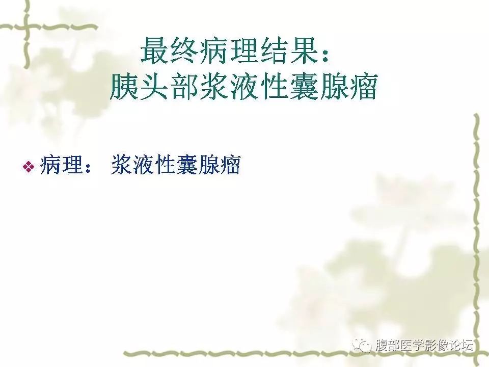 【病例】胰头浆液性囊腺瘤1例CT及MR 【病例】胰头浆液性囊腺瘤1例CT及MR