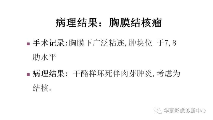 【病例】胸膜结核瘤1例CT影像表现