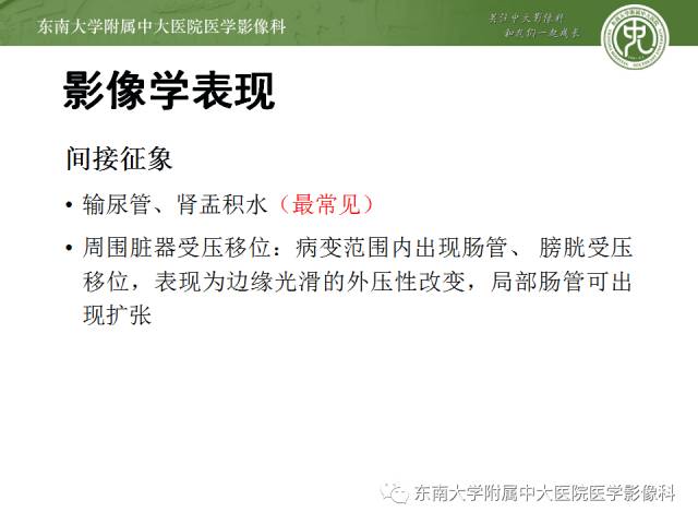 【病例】腹膜后纤维化1例CT影像表现