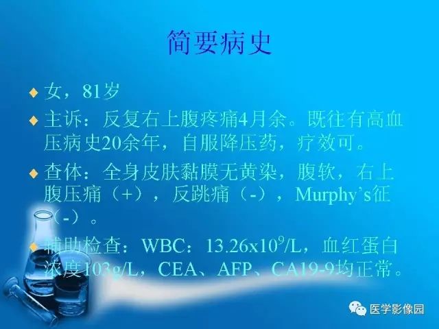 【病例】肾上腺髓样脂肪瘤髓样脂肪瘤1例CT影像表现