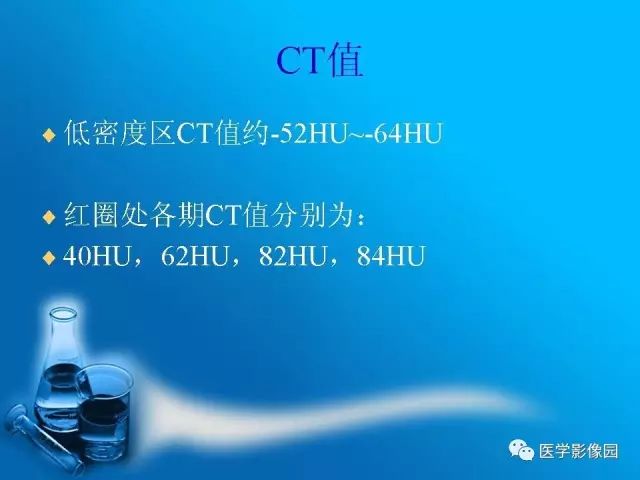 【病例】肾上腺髓样脂肪瘤髓样脂肪瘤1例CT影像表现 【病例】肾上腺髓样脂肪瘤髓样脂肪瘤1例CT影像表现