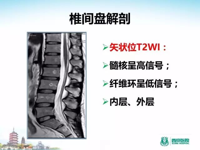 【PPT】容易忽视的腰椎退变MR表现
