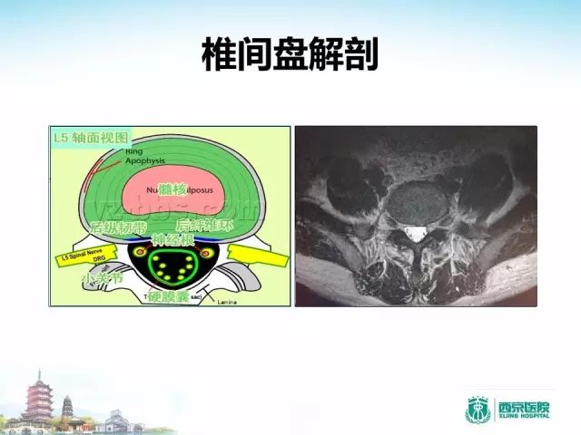 【PPT】容易忽视的腰椎退变MR表现