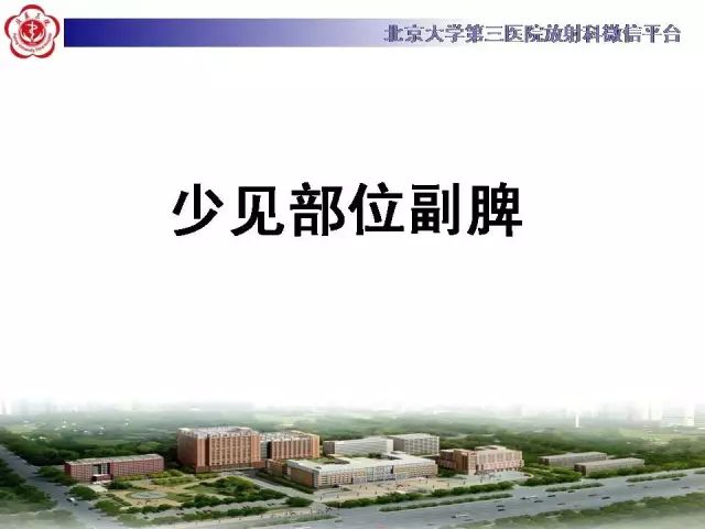 【病例】盆腔副脾蒂扭转1例CT