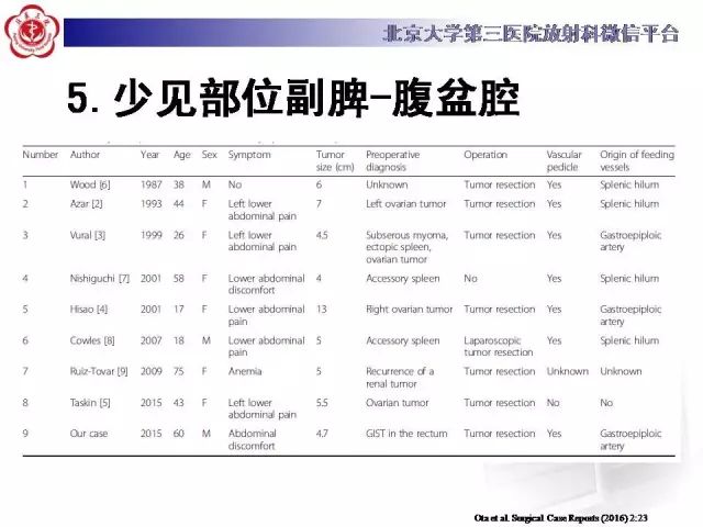【病例】盆腔副脾蒂扭转1例CT