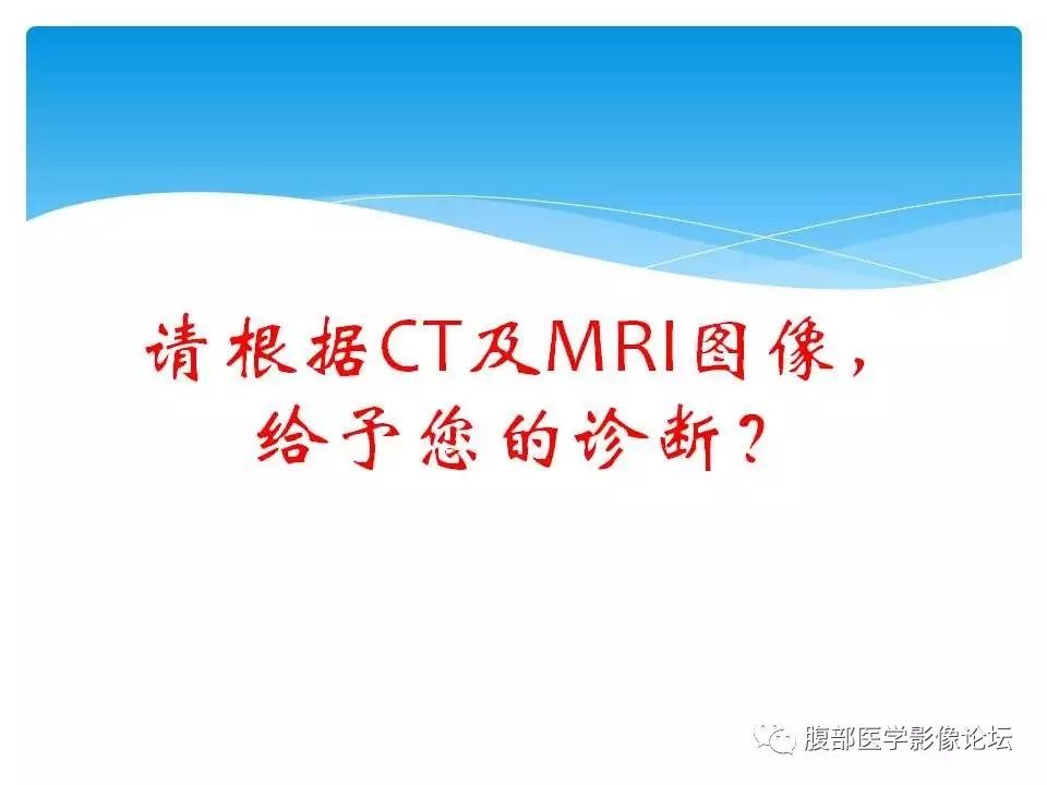 【病例】原发性肝癌1例CT及MR
