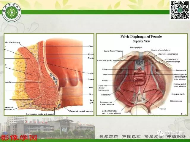 【PPT】复杂性肛瘘的MRI诊断