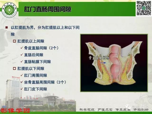 【PPT】复杂性肛瘘的MRI诊断