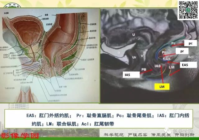 【PPT】复杂性肛瘘的MRI诊断