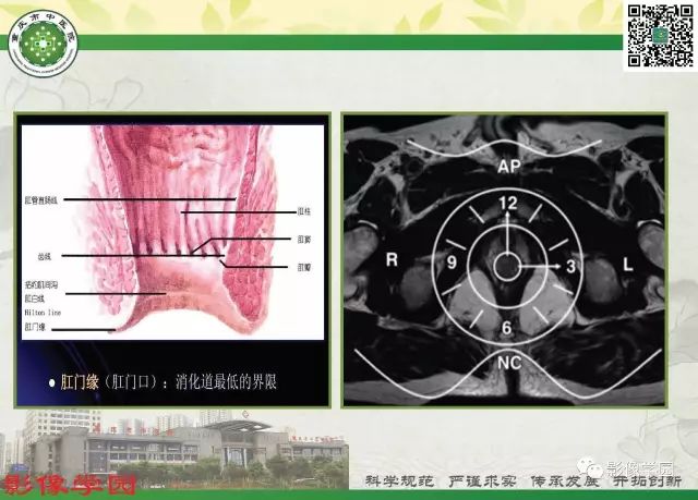 【PPT】复杂性肛瘘的MRI诊断