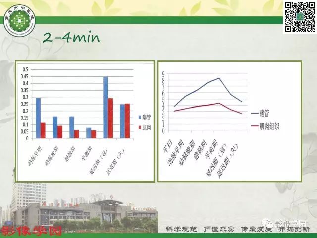 【PPT】复杂性肛瘘的MRI诊断