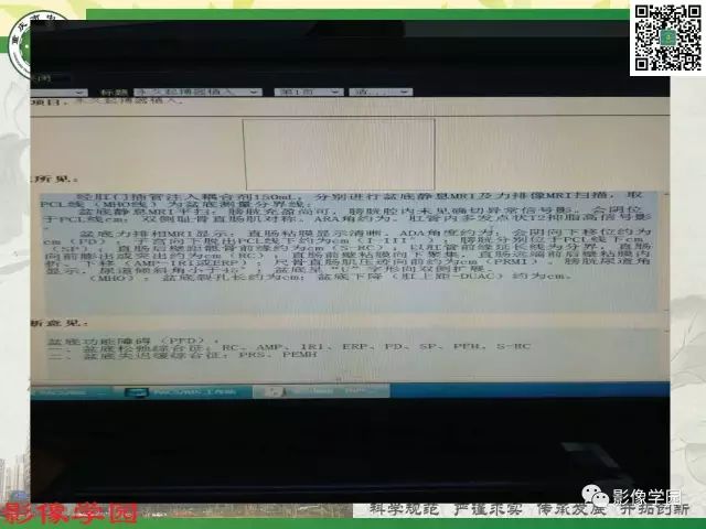 【PPT】复杂性肛瘘的MRI诊断