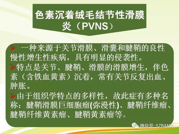 【PPT】色素沉着绒毛结节性滑膜炎