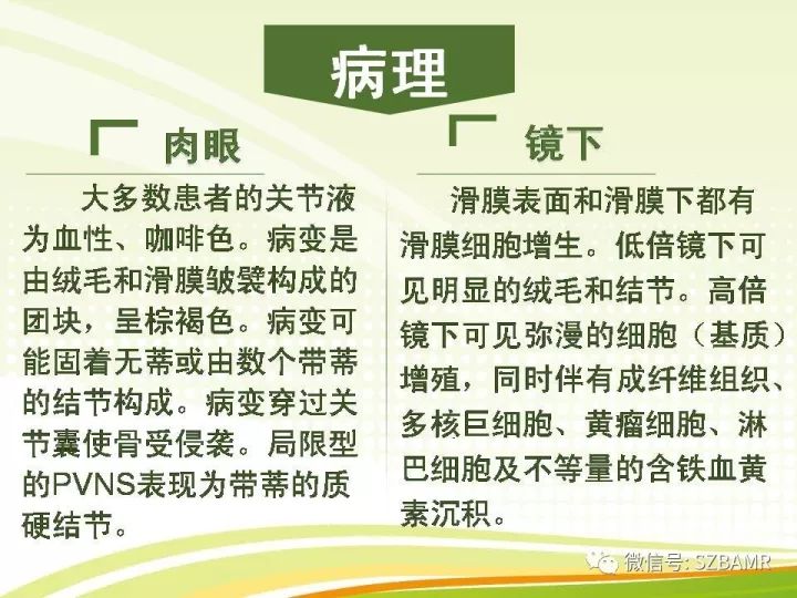【PPT】色素沉着绒毛结节性滑膜炎