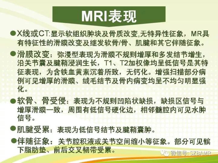 【PPT】色素沉着绒毛结节性滑膜炎