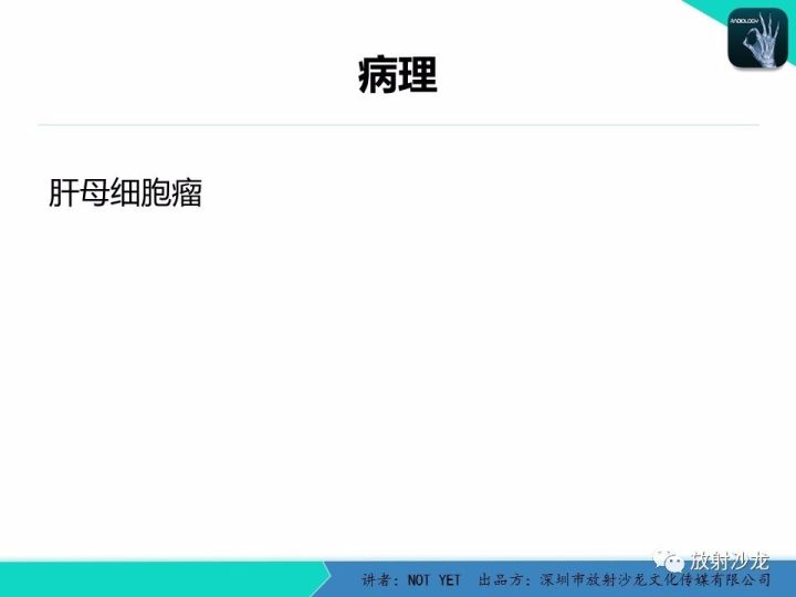 【病例】肝母细胞瘤1例CT影像表现