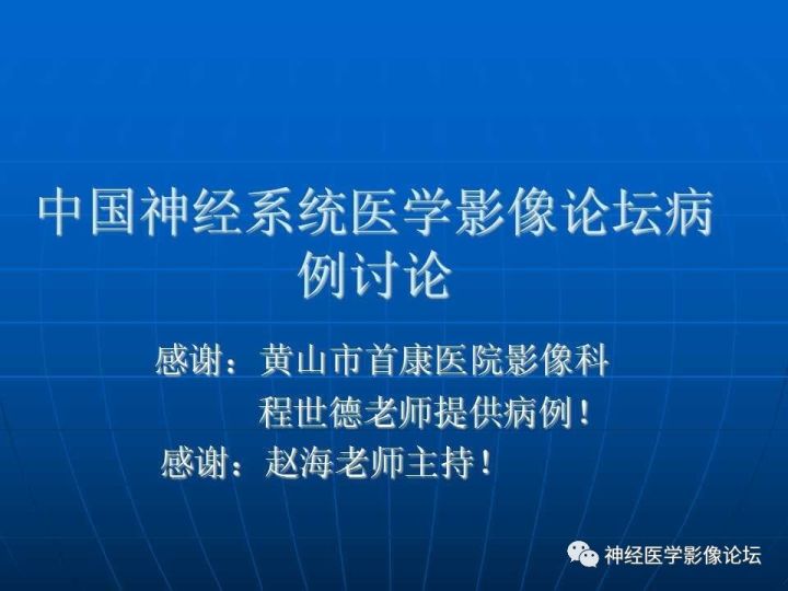 【病例】右侧丘脑间变型星形细胞瘤1例MR影像表现