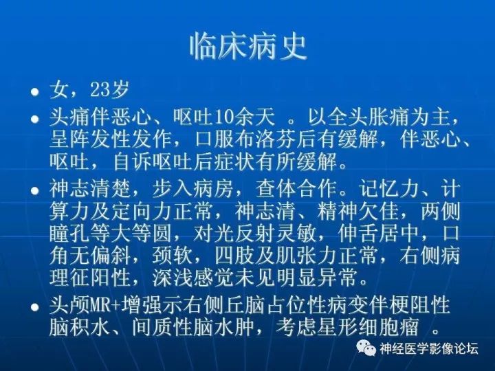 【病例】右侧丘脑间变型星形细胞瘤1例MR影像表现